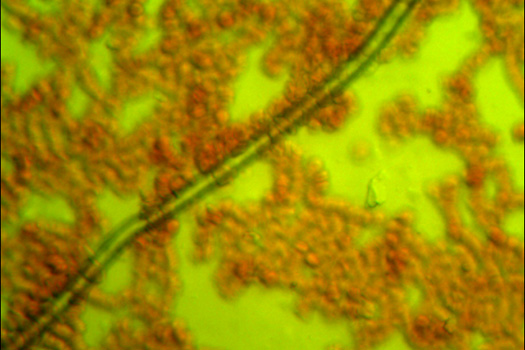Vércseppanalízis: parazita fonalféreg